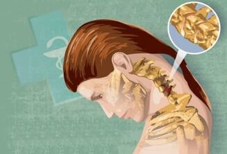 Symptoms of cervical osteochondrosis reflexes
