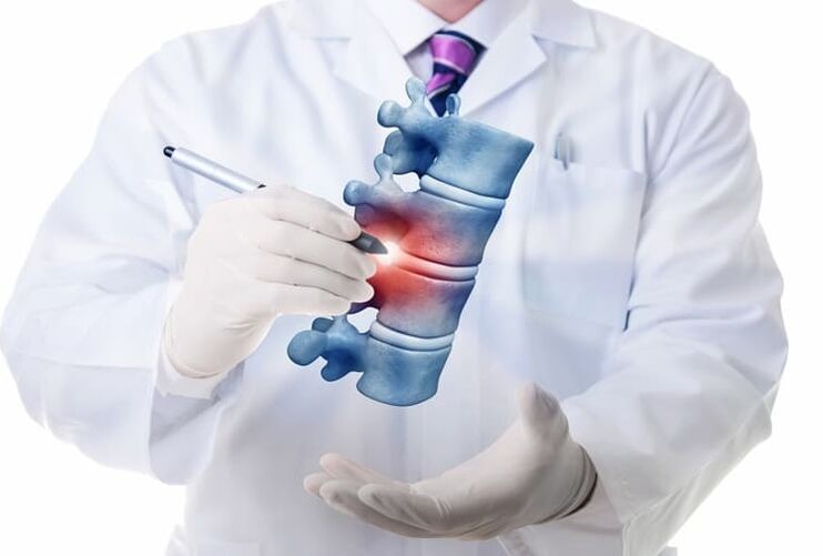spinal lesions due to thoracic osteochondrosis